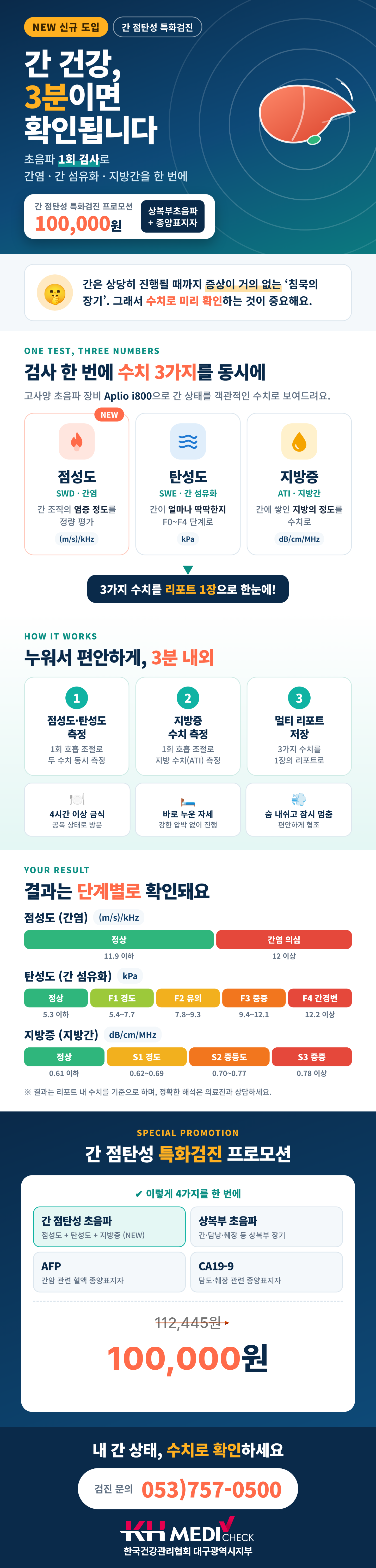 간 점탄성